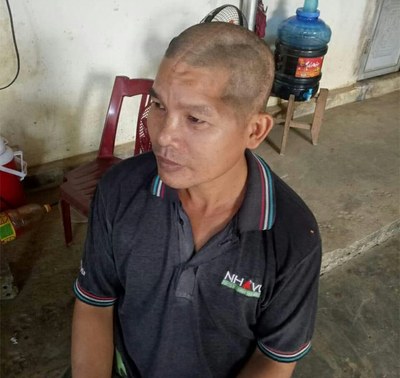 Ông Trần Văn Thanh ở Đắk Nông bị nhóm bảo vệ của Công ty Long Sơn gây thương tích đến 70%. Ông Trần Văn Thanh ở Đắk Nông bị nhóm bảo vệ của Công ty Long Sơn gây thương tích đến 70%.